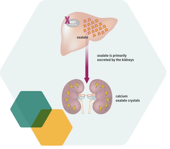 Primary Hyperoxaluria Type 1 Treatment Oxlumo™ Lumasiran